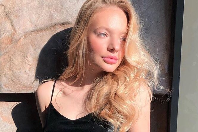 Лиза Пескова рассказала, как над ней из-за акне издевались европейские подростки Лиза Пескова рассказала, как над ней из-за акне издевались европейские подростки