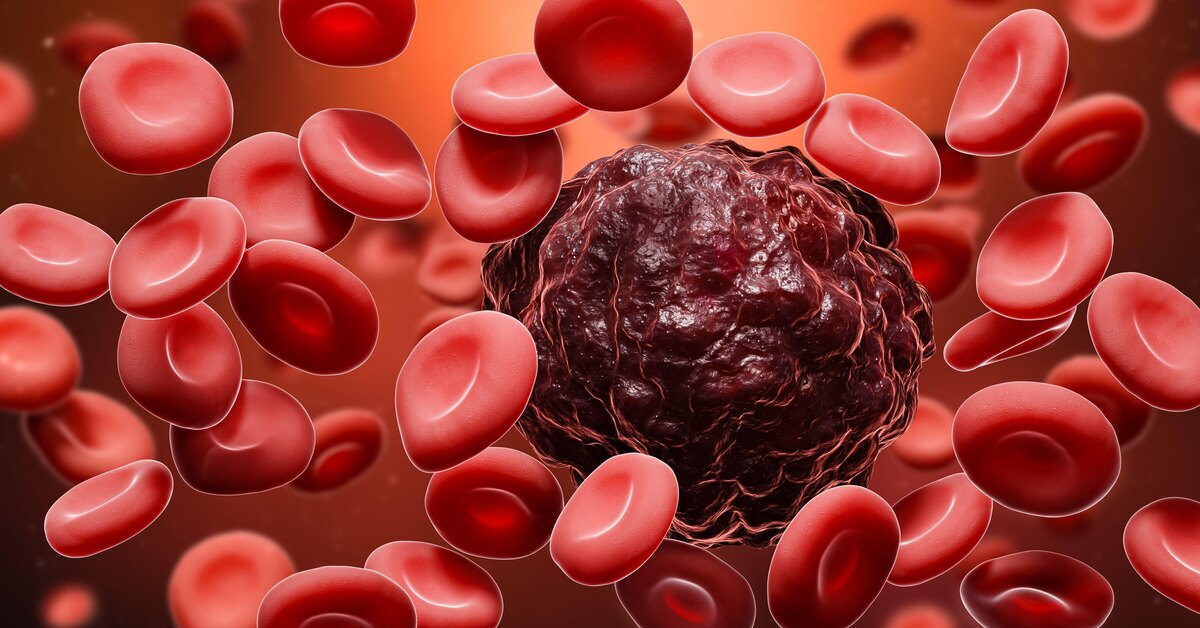 This symptom of cancer appears at night, but they do not pay attention to it: be vigilant!