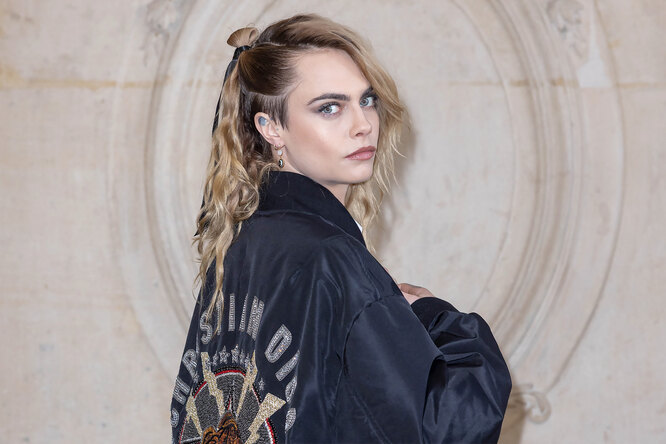 Can’t hide the pain and inflammation: How supermodel Cara Delevingne lives with psoriasis
