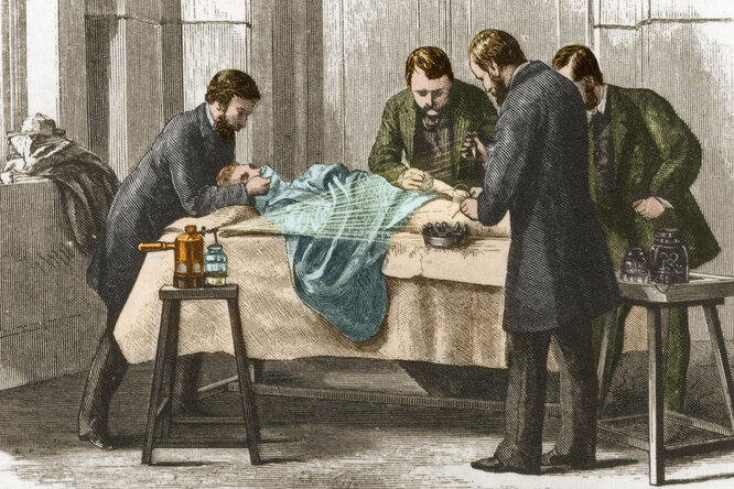Средство от всех болезней: женское обрезание в Викторианской Англии Средство от всех болезней: женское обрезание в Викторианской Англии