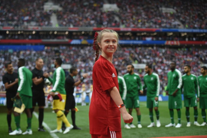 В матче открытия Чемпионата приняла участие девочка с синдромом Дауна