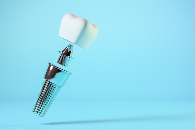 Why is implantation impossible without an orthopedic dentist?