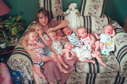 Первые в мире выжившие близнецы-семерняшки выросли (фото)