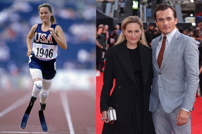 And It’s Beautiful: Celebrities Who Married Girls With Physical Disabilities