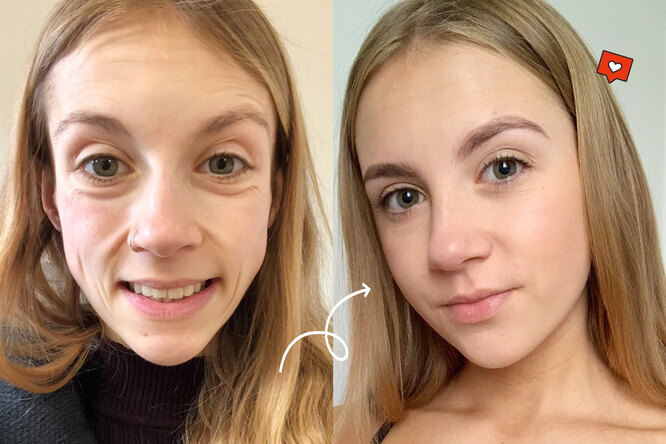Эта девушка победила анорексию: посмотри, как изменились ее лицо и тело