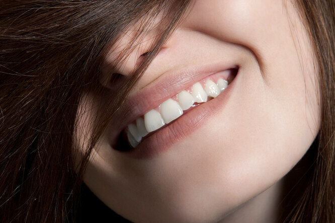 Голливудская улыбка: как отбелить зубы в домашних условиях