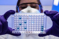Что известно о новом китайском вирусе Ланъя, который передался человеку от землеройки