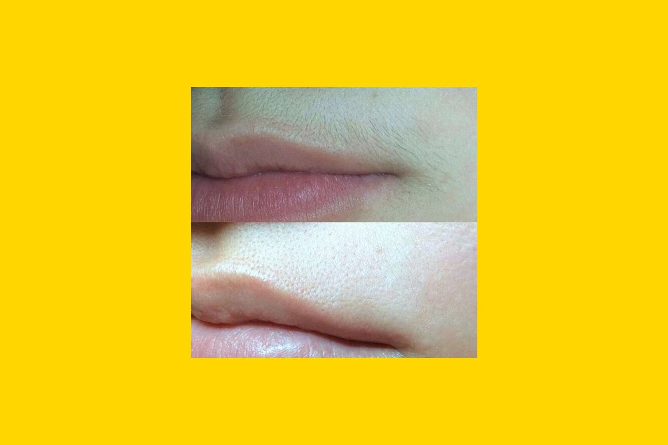 Две минуты, три копейки: как избавиться от женских усиков в домашних ...