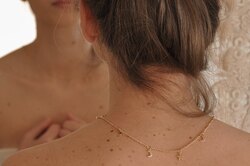 Почему стоит посчитать родинки на своем теле: обрати внимание, если их больше 50