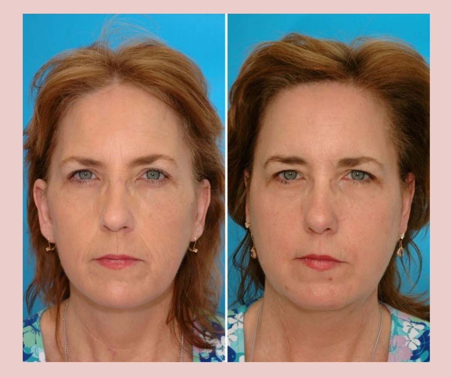 Генетика ни при чем: эти фото близнецов показывают реальные причины старения