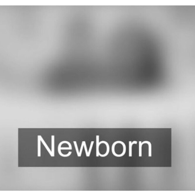 How Babies See the World Around Them: An Amazing Property of Our Vision