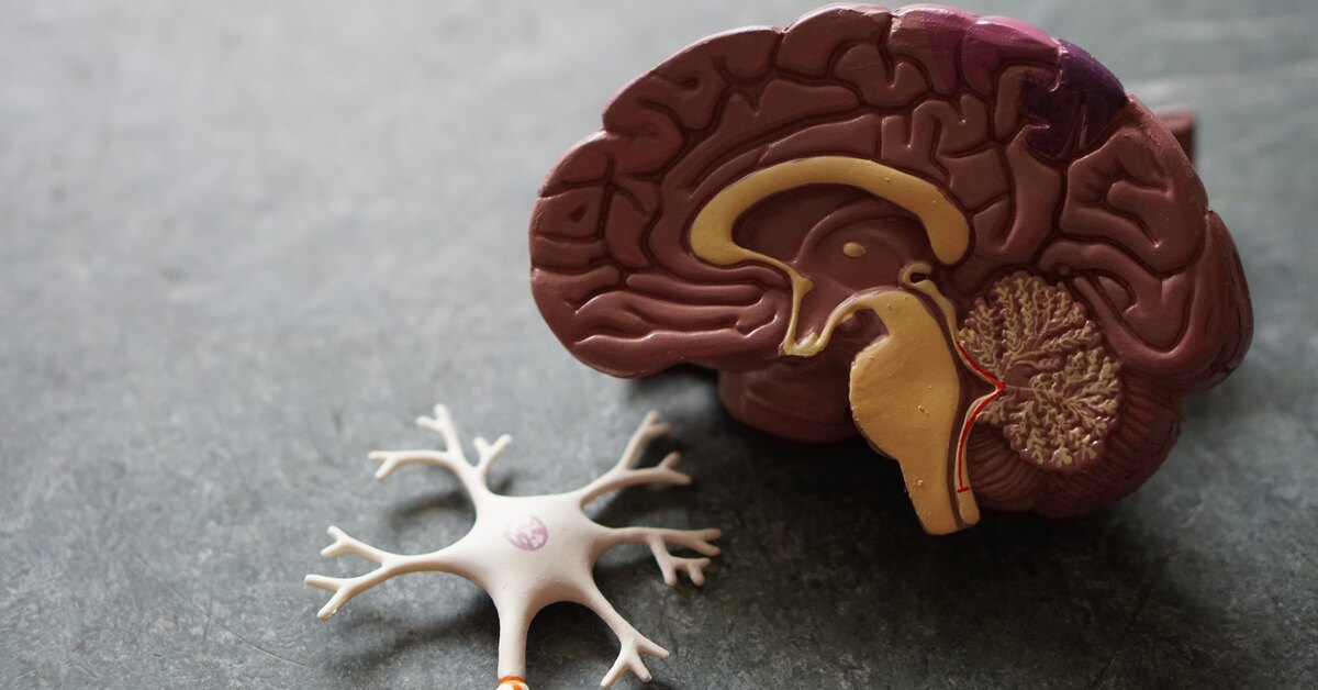 How to predict dementia years before diagnosis: three “silent” symptoms