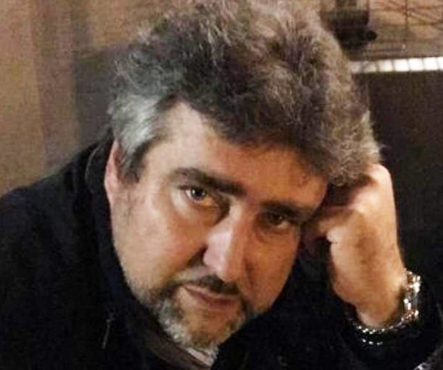 Сломанный нос и лицо в зеленке: режиссера Игоря Красникова избили в центре Москвы
