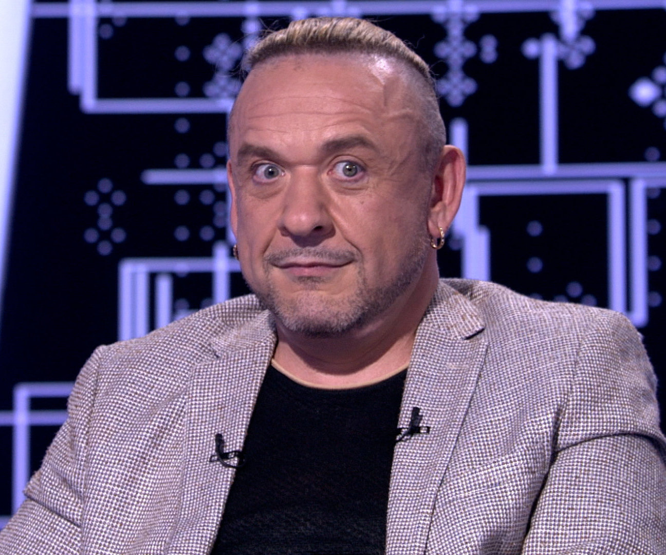 Я был женоподобным: феноменально похудевший Александр Морозов сделал пластику интимной зоны