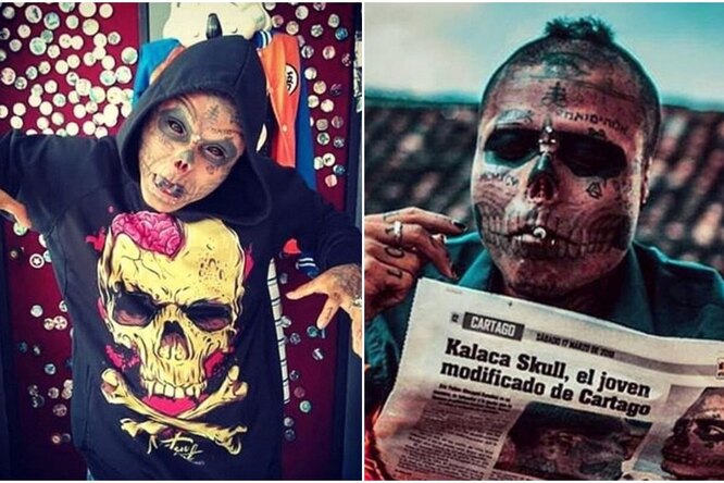 22-летний колумбиец отрезал нос и уши, чтобы его лицо напоминало череп