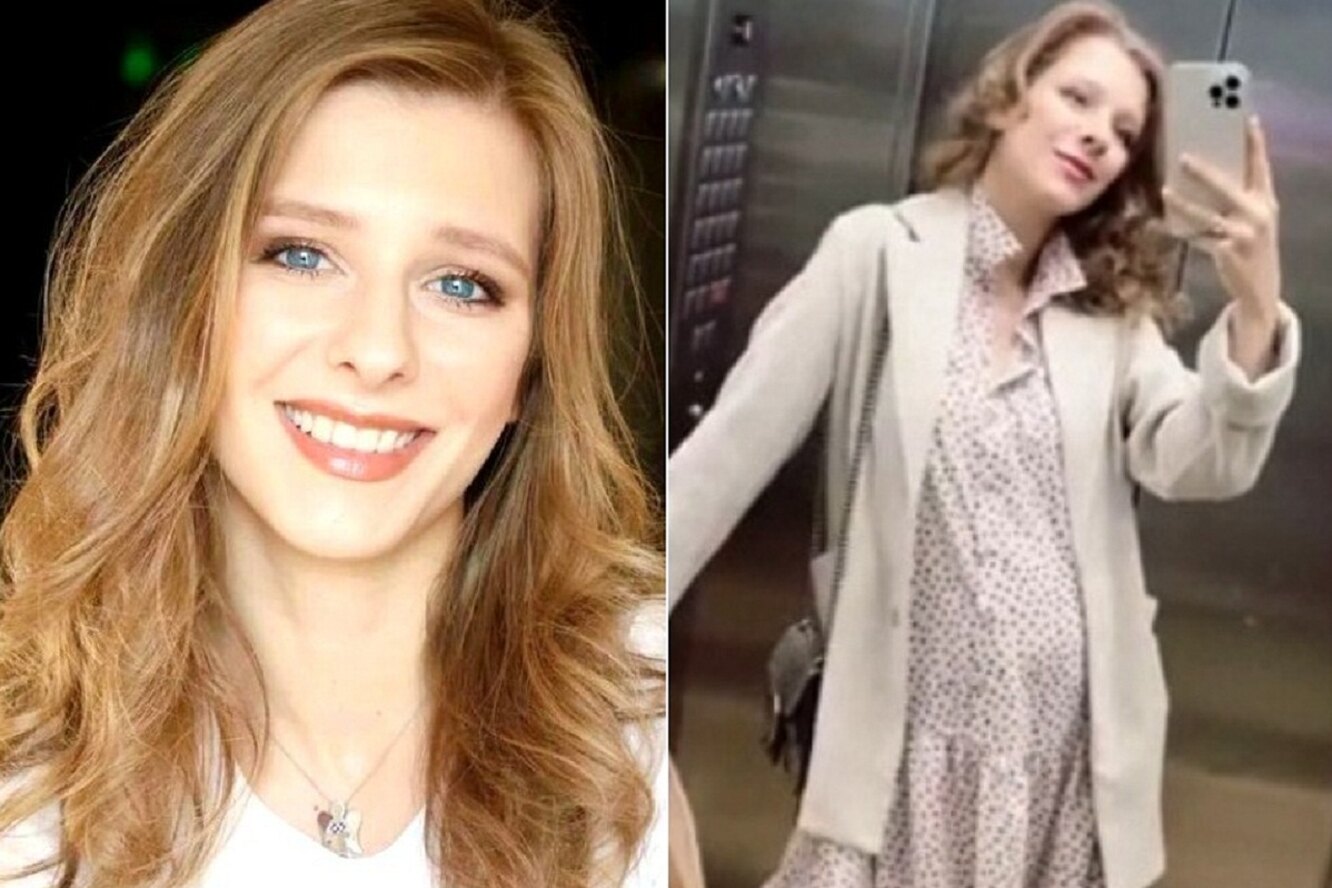 Лиза арзамасова до и после пластики