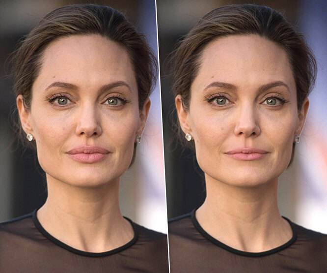 Джоли с тонкими губами? Как выглядели бы звезды без их «изюминки»